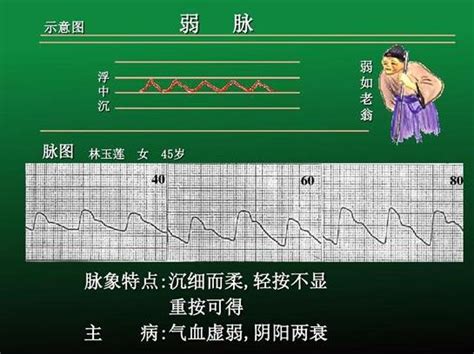 脈細數|脈細數